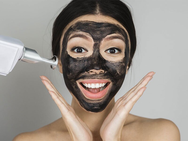 carbon-laser-facial-laser-treatment-img1-the-cosmetic-club-2023