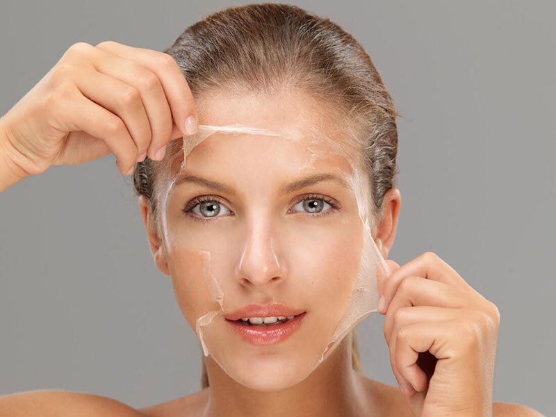 chemical-peels-skin-treatment-img1-the-cosmetic-club-2023