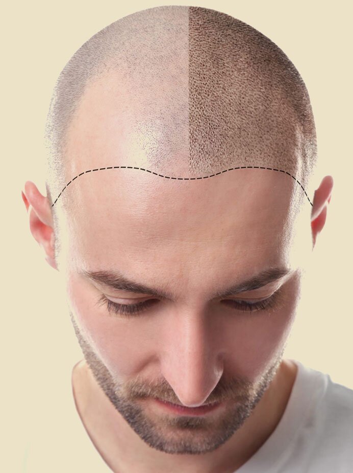 home-smp-hair-treatment-img1-the-cosmetic-club-2023