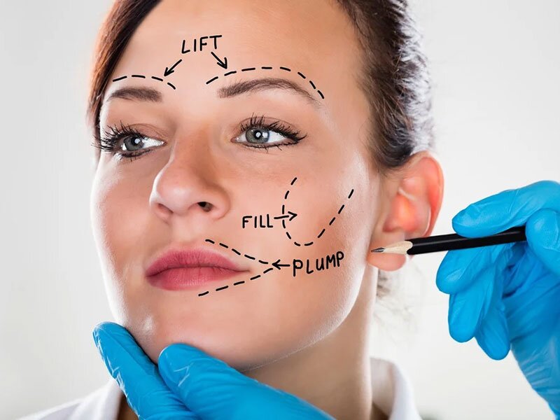 facelift-injectables-treatment-img1-the-cosmetic-club-2023